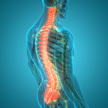 Spinal cord injury Attorney in St. Louis